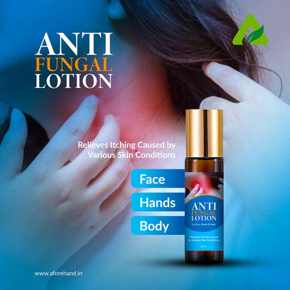 ANTI FUNGAL LOTION